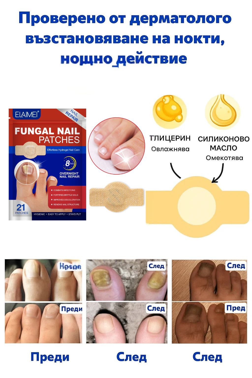 Rootaura™– Лепенки за здрави нокти