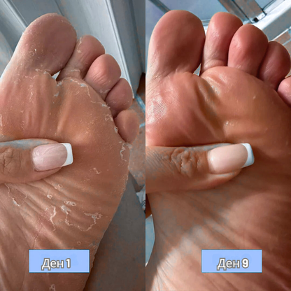 RootAura™ Крем за сухи и напукани пети