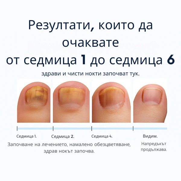 Rootaura™– Лепенки за здрави нокти