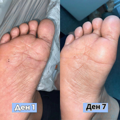 RootAura™ Крем за сухи и напукани пети