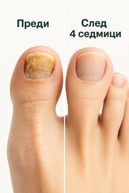 Rootaura™– Лепенки за здрави нокти