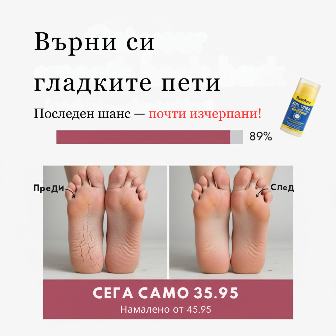 RootAura™ Крем за сухи и напукани пети