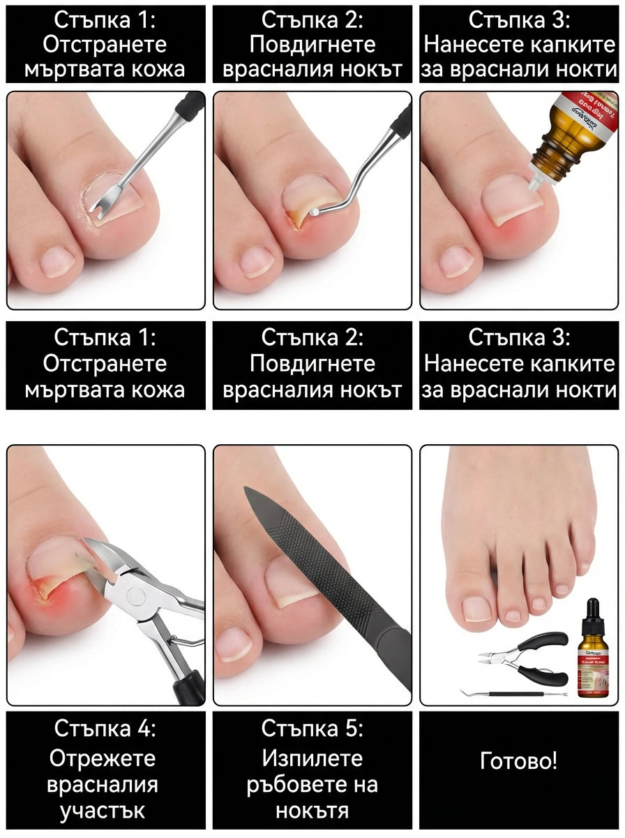 RootAura™ Пълна грижа за врастнали нокти