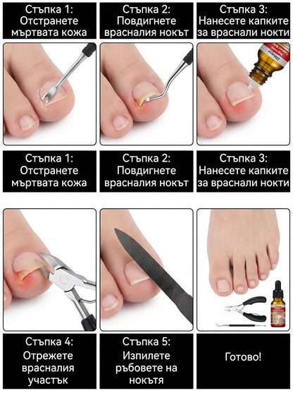 RootAura™ Пълна грижа за врастнали нокти