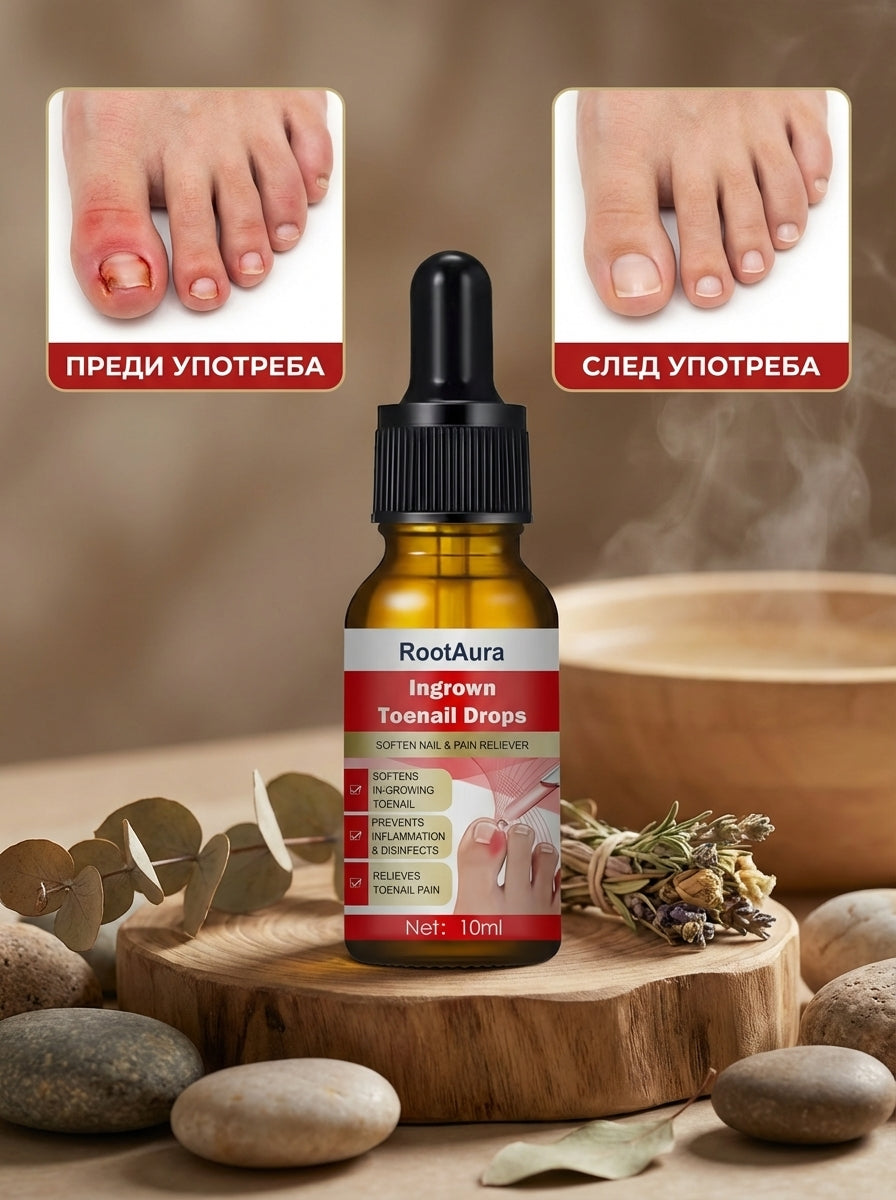RootAura™ Капки за врастнали нокти