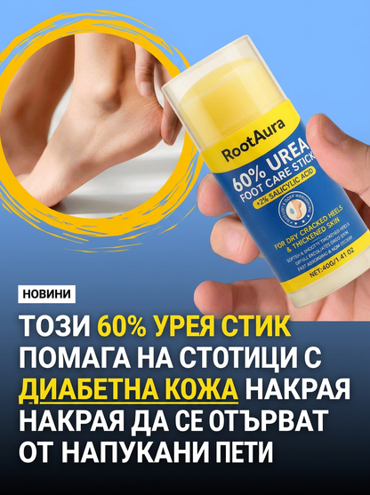RootAura™ Крем за сухи и напукани пети