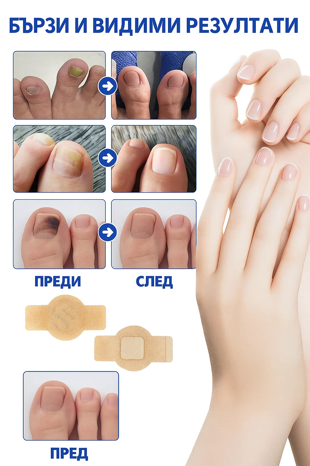 Rootaura™– Лепенки за здрави нокти